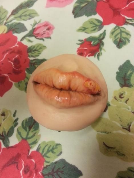 cold sore