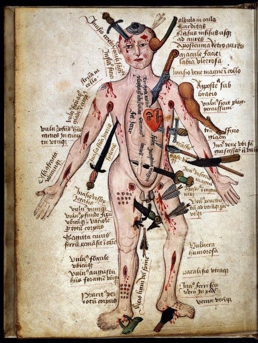 wound man