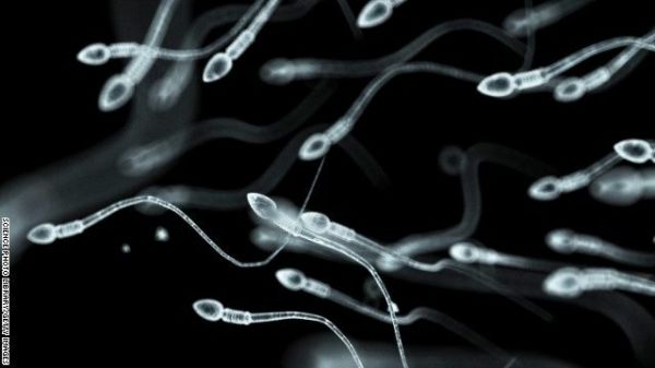 pre-seminal fluid in Sperm