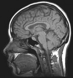 brains
