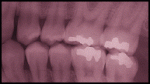 teeth