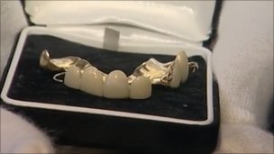 Churchill dentures