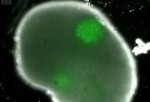 Ovary_1