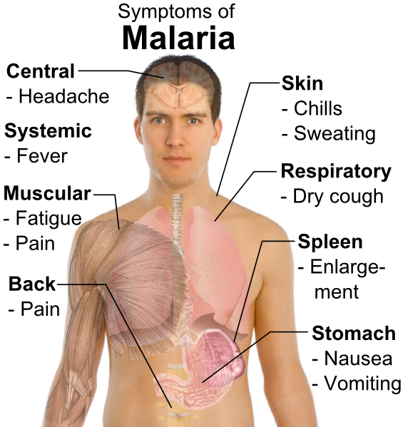 Symptoms_of_Malaria