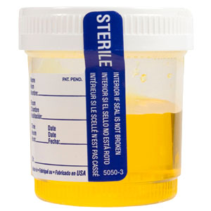 urinesample1