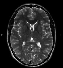 220_fMRI_wholebrain