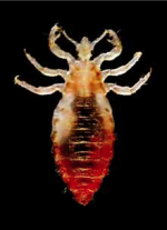 lice
