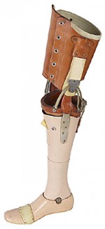 leg
