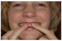200_Braceguard