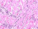 hearttissue