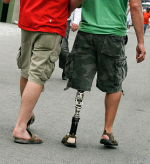 prosthetic