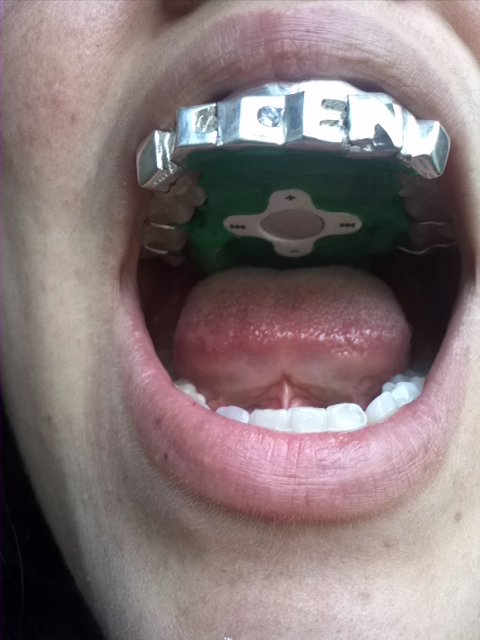 grill