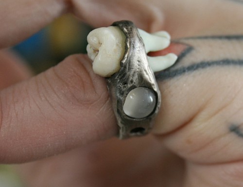 ring tooth