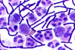 bacteriaAnthrax