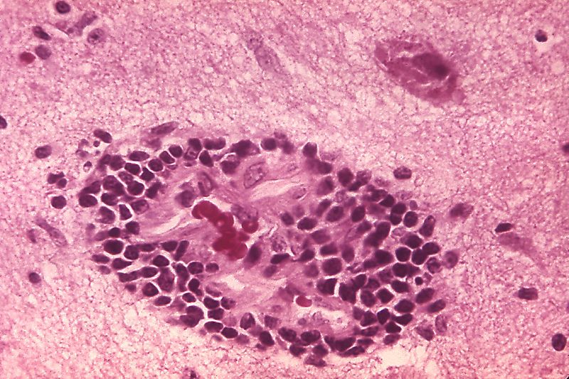 Rabies Virus Ribonucleoprotein Structure Decoded - Neatorama