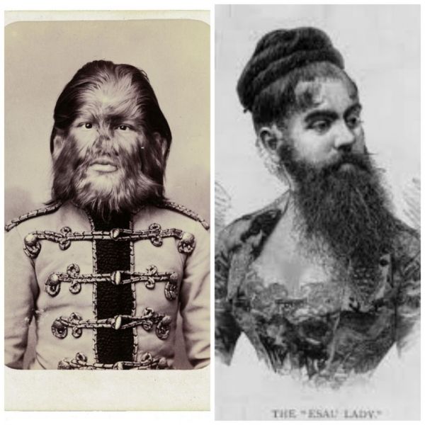 True Tales Of The Bearded Lady And The Dog-Faced Boy - Neatorama